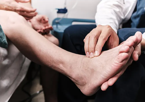 Peripheral Neuropathy